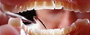 Лечение зубов для многих из нас представляет большую проблему. В России так сложилось, что посещение стоматолога у многих людей ассоциируется, чуть ли не с добровольным посещением инквизитора.