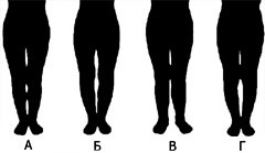 НОГИ - идеальная форма ног характеризуется наличием трех веретенообразных дефектов внутреннего контура, ограниченных промежностью, сомкнутыми коленными суставами, массивом мягких тканей в верхней трети голени и лодыжками