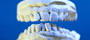 Протезирование зубов дает возможность восстановить удаленные или утраченные в результате болезни или травмы зубы.